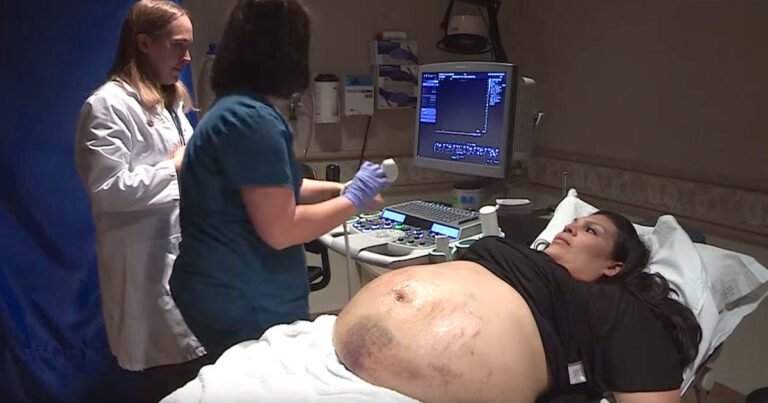 Super Mom Gives Birth To Quintuplets And Is Applauded By Her Doctors.